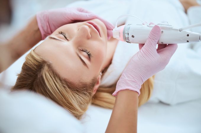 PROFESSIONELLES MICRONEEDLING MIT RADIOFREQUENZ