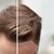 „STAY SAFE PLUS“ - RUNDUM-PFLEGE NACH IHRER HAARTRANSPLANTATION